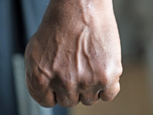 ПОРЯДКА 1,9 ТЫС. РУБЛЕЙ ВЫПЛАТИТ ПРОФСОЮЗ МЕДРАБОТНИКУ С МОЗЫРЩИНЫ, ПОСТРАДАВШЕМУ ОТ ДЕЙСТВИЙ АГРЕССИВНОГО ПАЦИЕНТА.