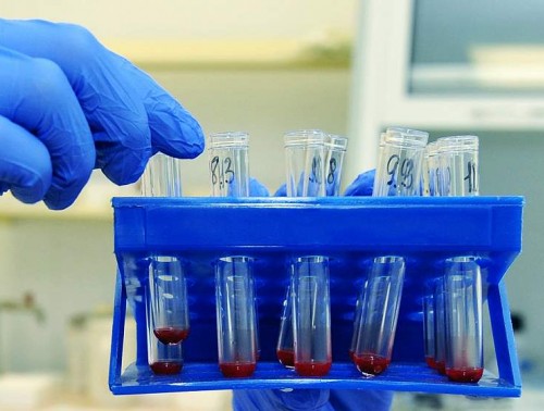 БОРЕМСЯ С РАКОМ ПО-БЕЛОРУССКИ