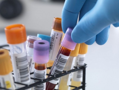 МИНЗДРАВ ОПРЕДЕЛИЛ ПРЕДЕЛЬНЫЕ ТАРИФЫ СТОИМОСТИ АНАЛИЗОВ