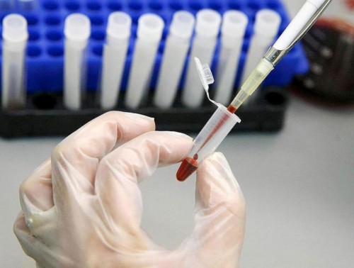 БЕЛОРУСЫ МОГУТ БЕСПЛАТНО СДАТЬ ТЕСТ НА ВИЧ И ВИРУСНЫЕ ГЕПАТИТЫ В И С  